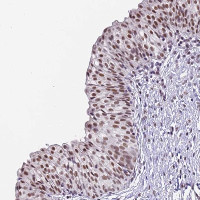 FNBP4 Antibody - BSA Free Immunohistochemistry-Paraffin: FNBP4 Antibody [NBP2-14022]