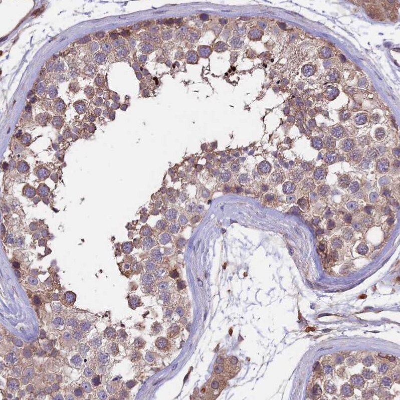 GAS8 Antibody - BSA Free Immunohistochemistry: GAS8 Antibody - BSA Free [NBP2-14037]