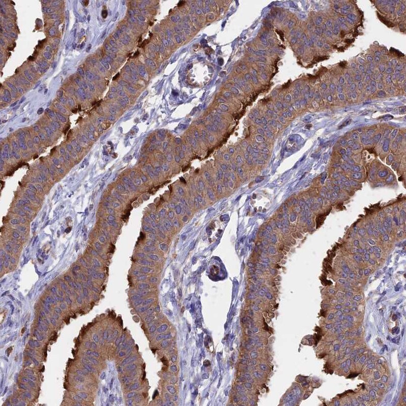 GAS8 Antibody - BSA Free Immunohistochemistry: GAS8 Antibody - BSA Free [NBP2-14037]