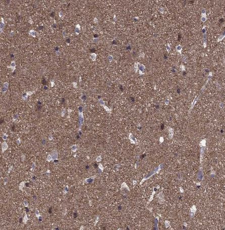 HCN1 Antibody HCN1 Antibody