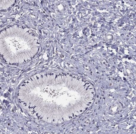 HCN1 Antibody HCN1 Antibody