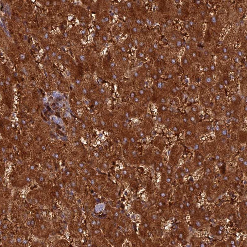 HHAT Antibody - BSA Free Immunohistochemistry-Paraffin: HHAT Antibody [NBP2-14089]