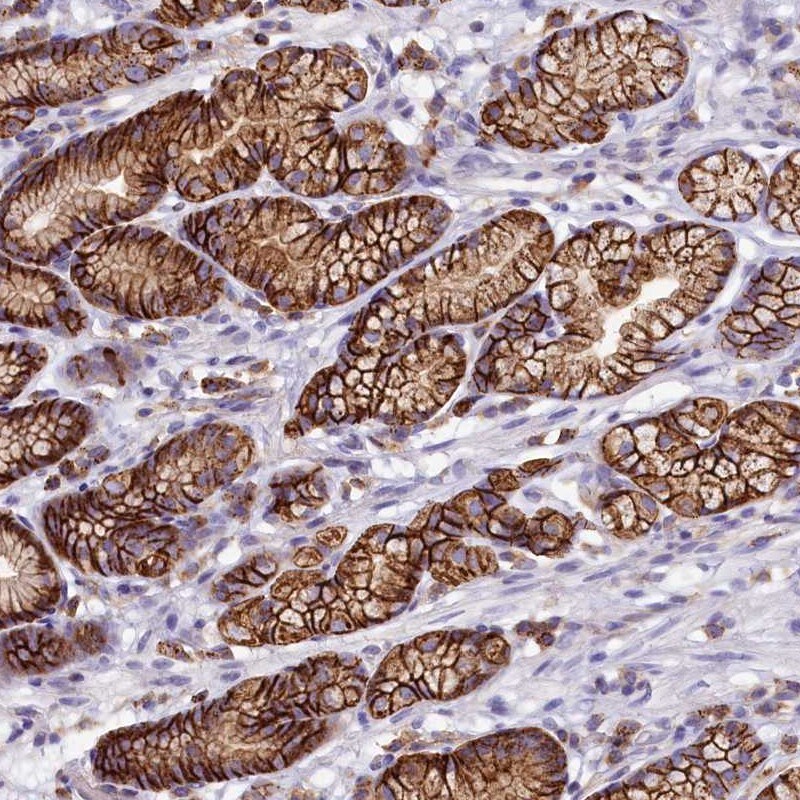 HPS6 Antibody - BSA Free Immunohistochemistry-Paraffin: HPS6 Antibody [NBP2-14100]
