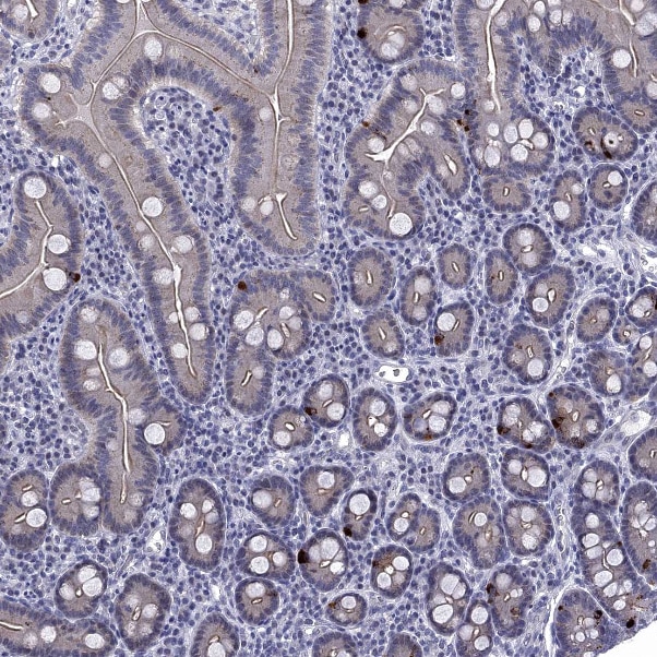 5-HT4 Antibody - BSA Free Immunohistochemistry-Paraffin: 5-HT4 Antibody [NBP2-14109]