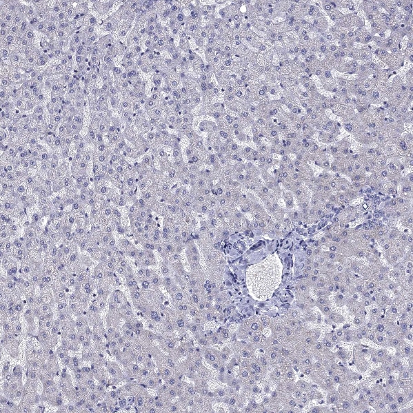 5-HT4 Antibody - BSA Free Immunohistochemistry-Paraffin: 5-HT4 Antibody [NBP2-14109]