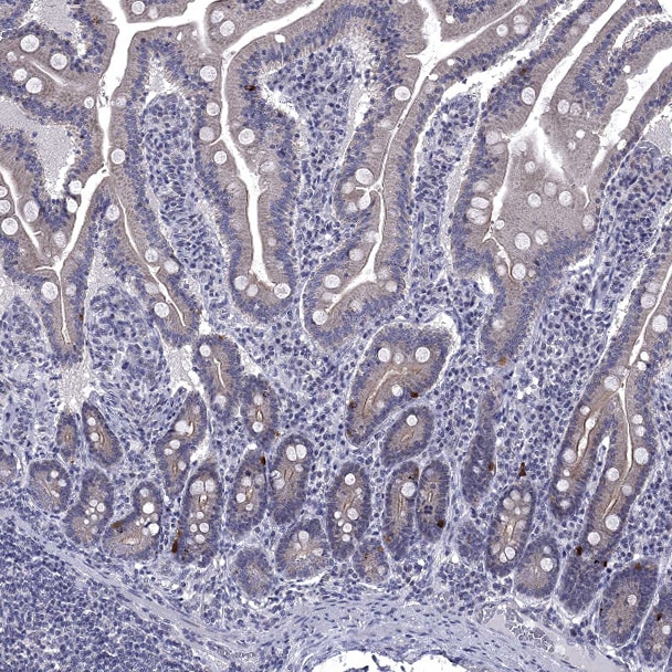 5-HT4 Antibody - BSA Free Immunohistochemistry-Paraffin: 5-HT4 Antibody [NBP2-14109]