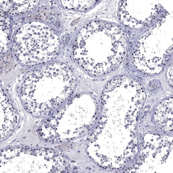5-HT4 Antibody - BSA Free Immunohistochemistry-Paraffin: 5-HT4 Antibody [NBP2-14109]