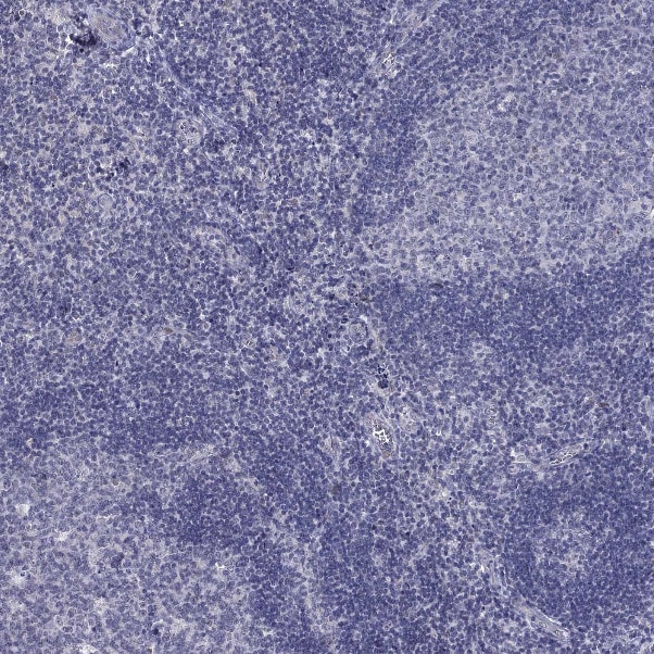 5-HT4 Antibody - BSA Free Immunohistochemistry-Paraffin: 5-HT4 Antibody [NBP2-14109]