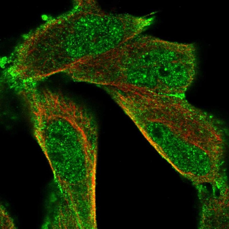 HUNK Antibody - BSA Free Immunocytochemistry/ Immunofluorescence: HUNK Antibody [NBP2-14110]