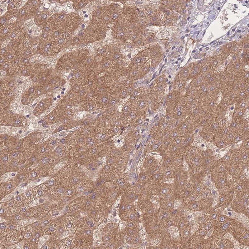 Insulin R/CD220 Antibody - BSA Free Immunohistochemistry: Insulin R/CD220 Antibody - BSA Free [NBP2-14124]
