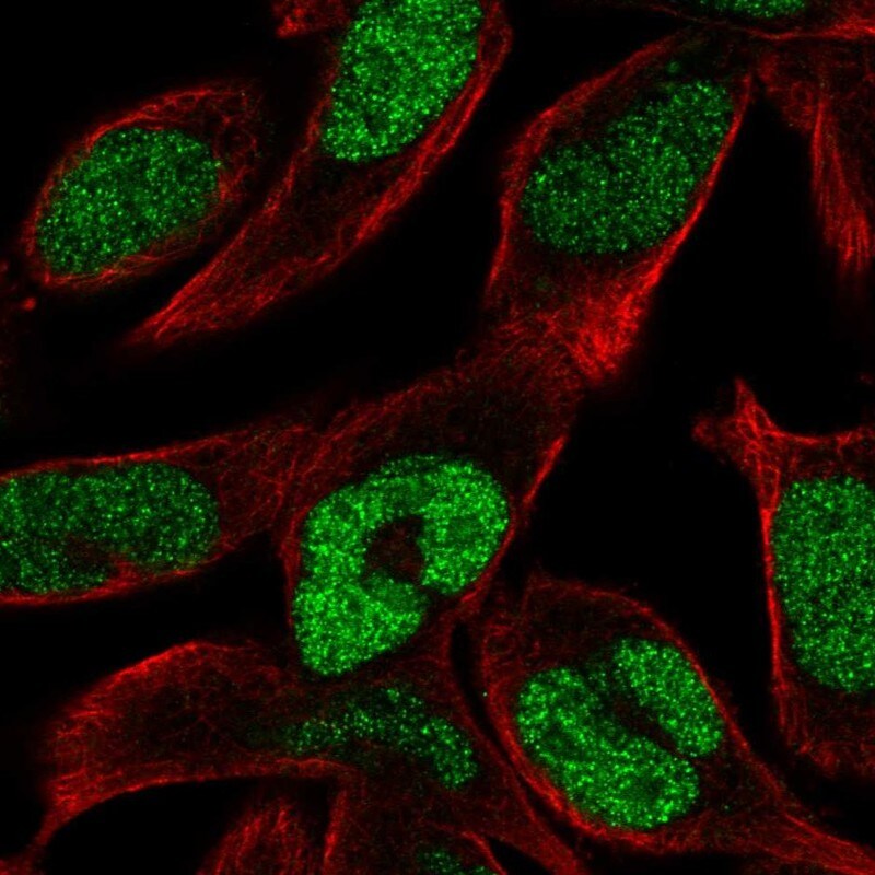 ECM29 Antibody - BSA Free Immunocytochemistry/ Immunofluorescence: ECM29 Antibody [NBP2-14153]