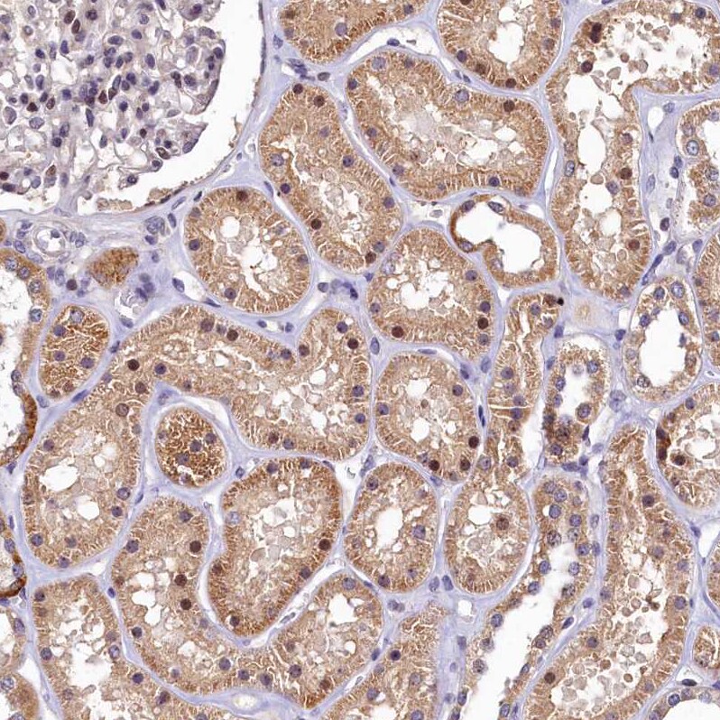 LATS2 Antibody - BSA Free Immunohistochemistry: LATS2 Antibody - BSA Free [NBP2-14184]