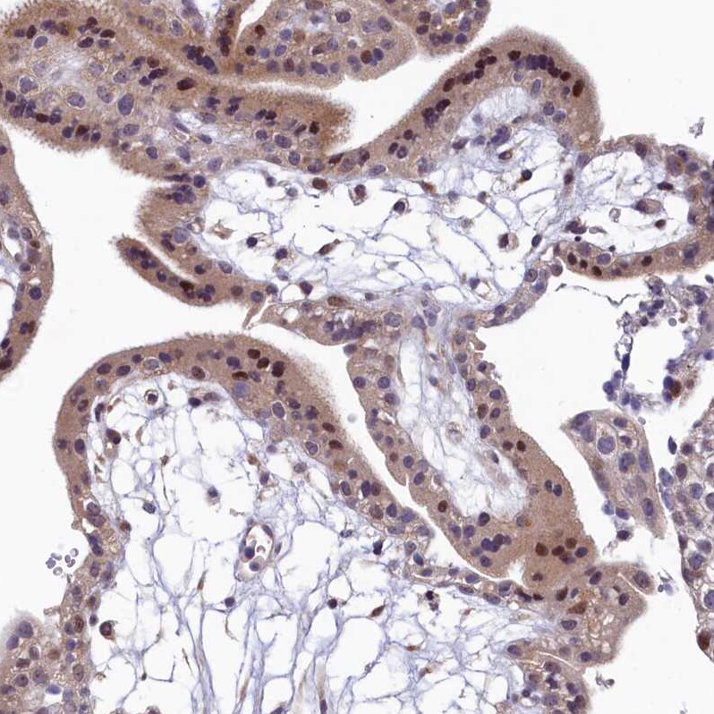 LATS2 Antibody - BSA Free Immunohistochemistry: LATS2 Antibody - BSA Free [NBP2-14184]