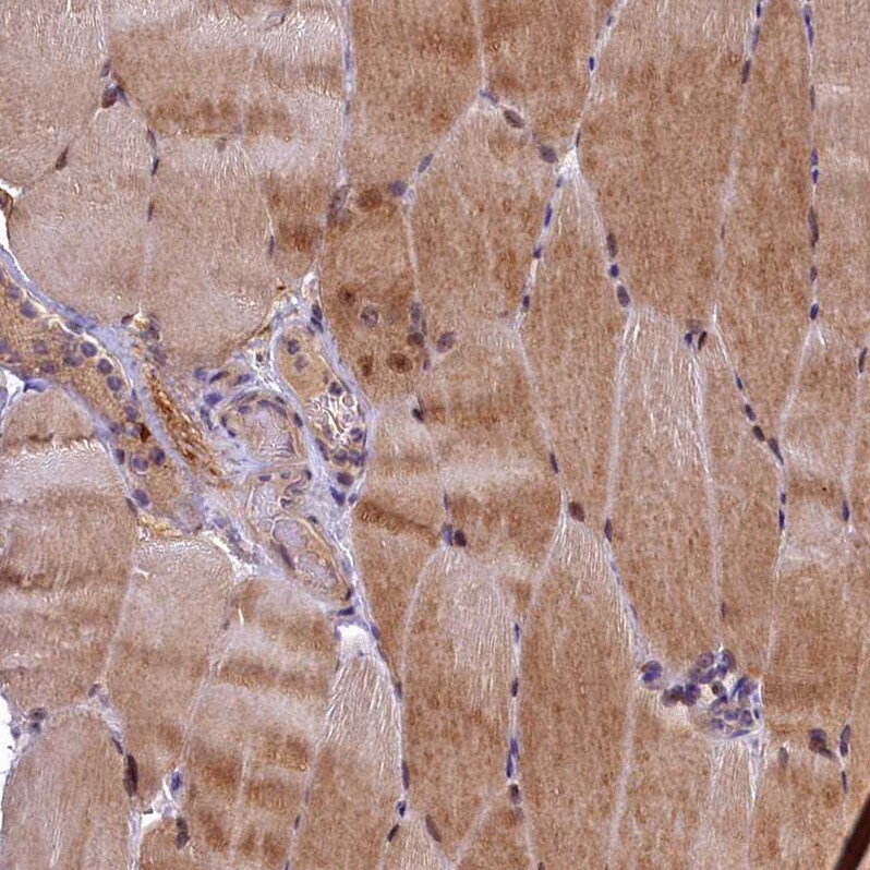 LATS2 Antibody - BSA Free Immunohistochemistry: LATS2 Antibody - BSA Free [NBP2-14184]