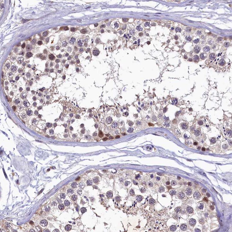 LATS2 Antibody - BSA Free Immunohistochemistry: LATS2 Antibody - BSA Free [NBP2-14184]