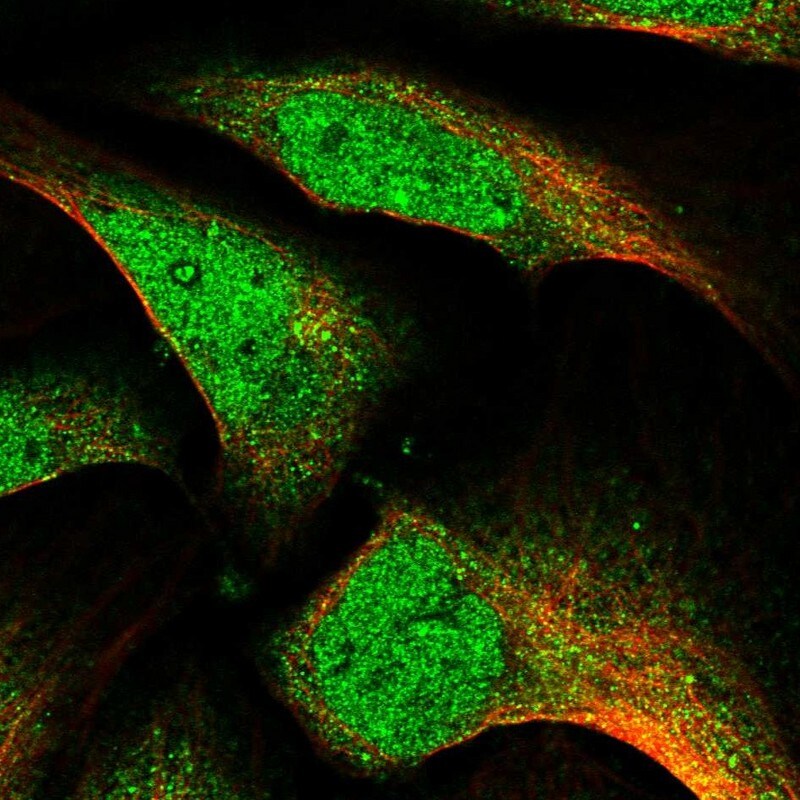 LCMT1 Antibody - BSA Free Immunocytochemistry/ Immunofluorescence: LCMT1 Antibody [NBP2-14188]