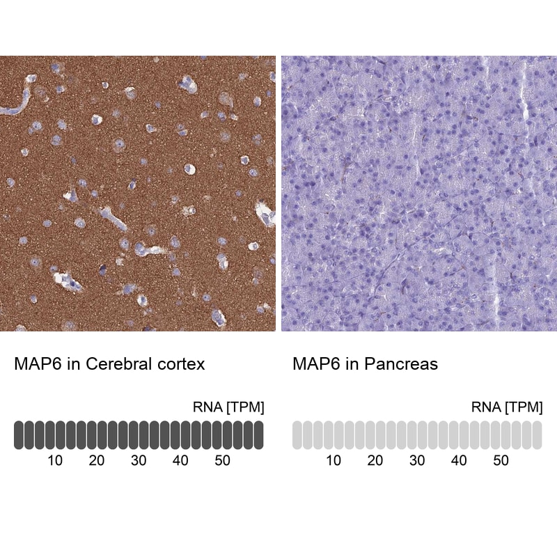 MAP6 Antibody - BSA Free Immunohistochemistry-Paraffin: MAP6 Antibody [NBP2-14221]