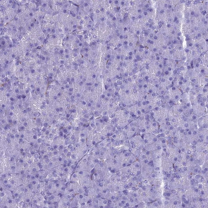 MAP6 Antibody - BSA Free Immunohistochemistry-Paraffin: MAP6 Antibody [NBP2-14221]