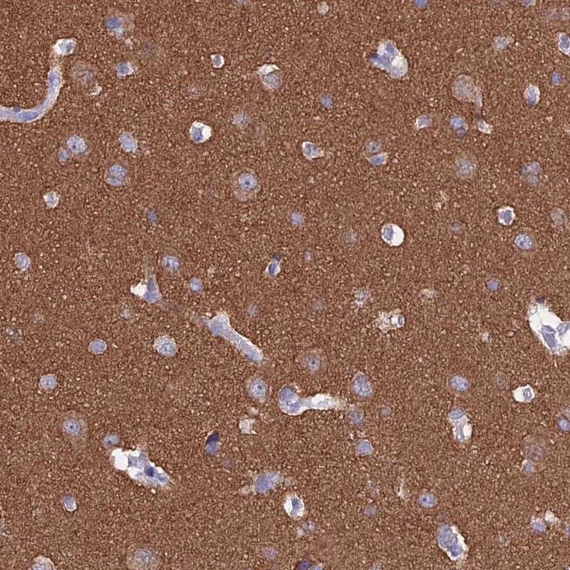MAP6 Antibody - BSA Free Immunohistochemistry-Paraffin: MAP6 Antibody [NBP2-14221]