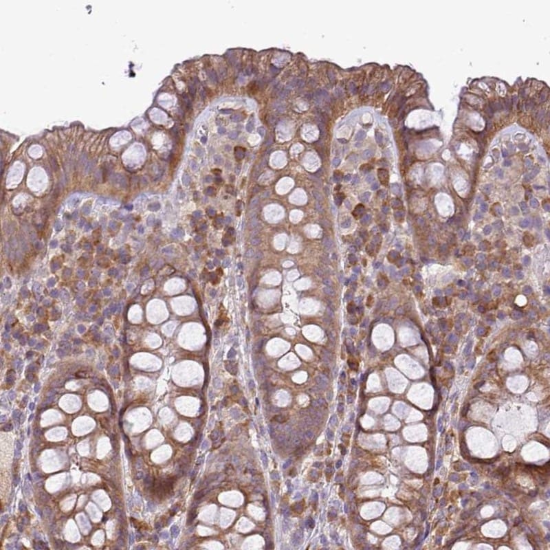 MOCS3 Antibody - BSA Free Immunohistochemistry: MOCS3 Antibody - BSA Free [NBP2-14244]