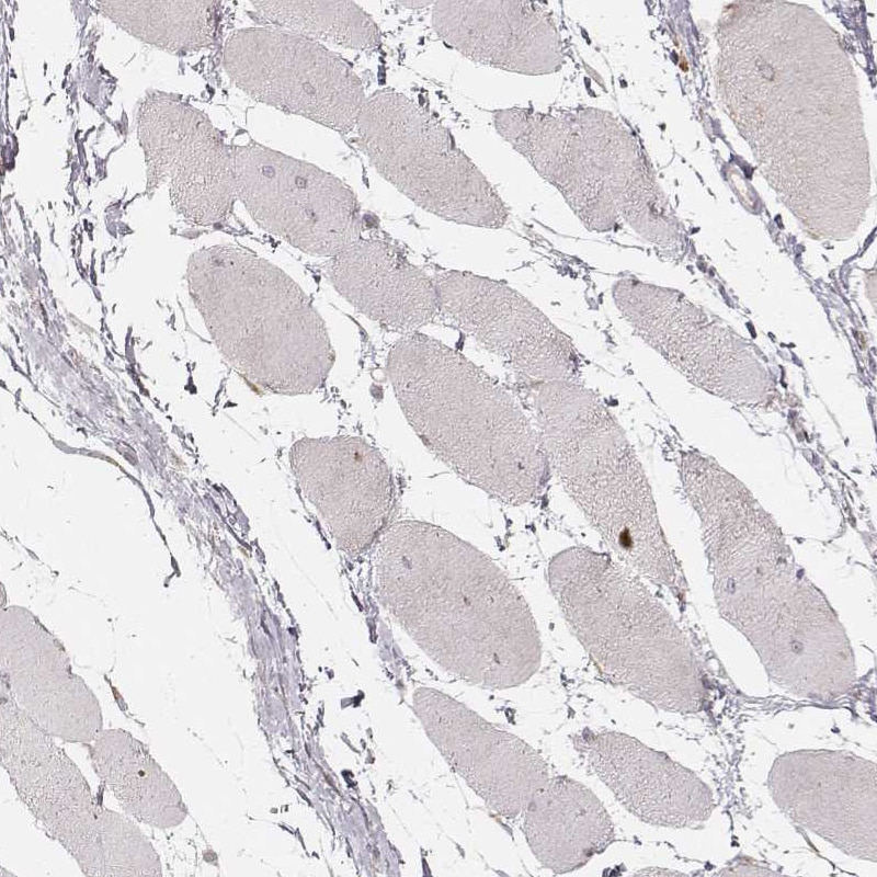 ABCA7 Antibody - BSA Free Immunohistochemistry-Paraffin: ABCA7 Antibody [NBP2-14250]