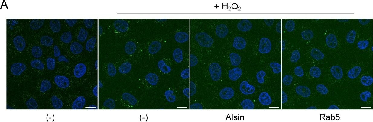 Als2 Antibody