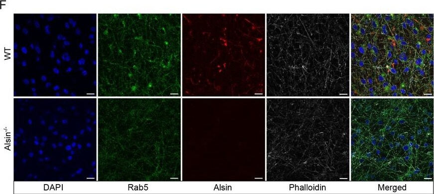 Als2 Antibody