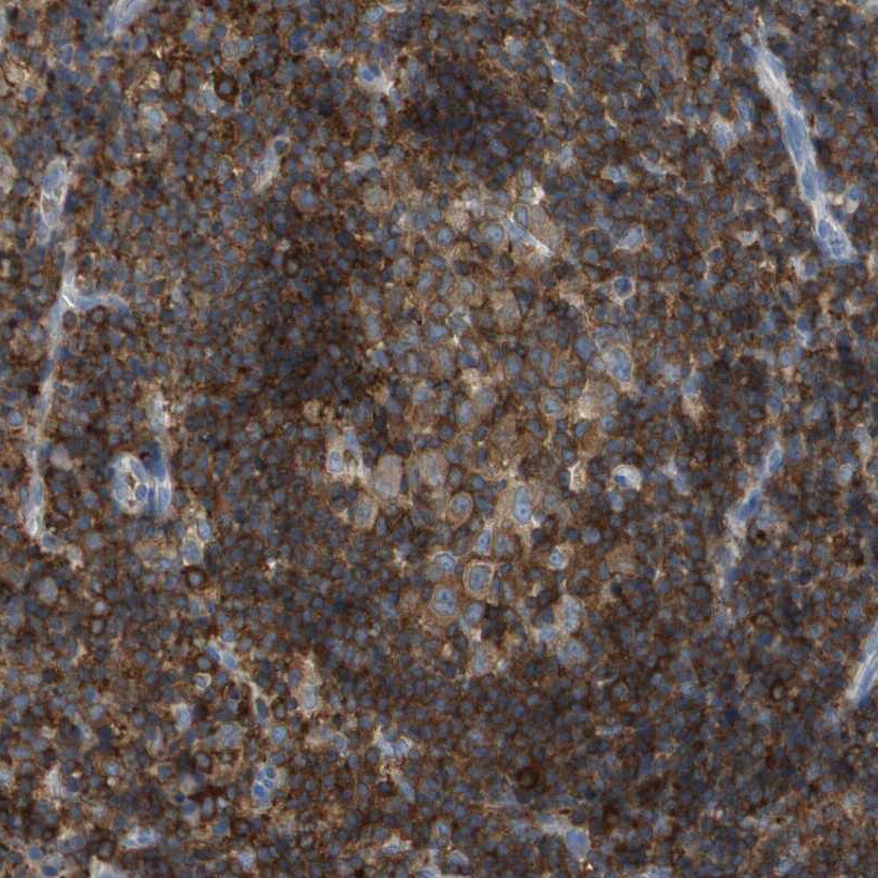 RIAM/APBB1IP Antibody - BSA Free Immunohistochemistry-Paraffin: RIAM/APBB1IP Antibody [NBP2-14300]