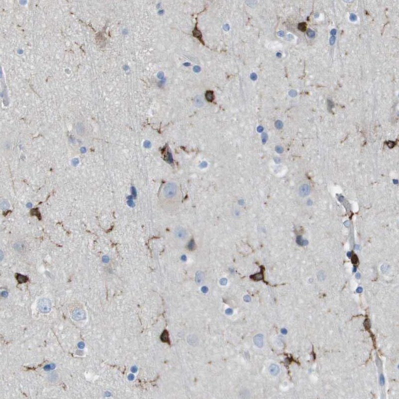 RIAM/APBB1IP Antibody - BSA Free Immunohistochemistry-Paraffin: RIAM/APBB1IP Antibody [NBP2-14300]