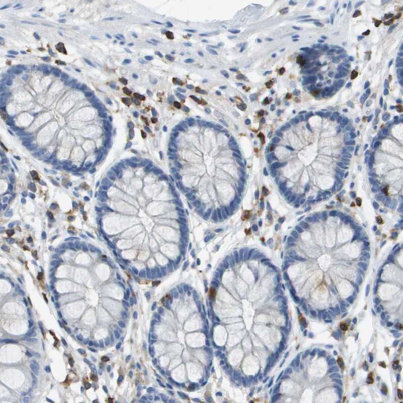 RIAM/APBB1IP Antibody - BSA Free Immunohistochemistry-Paraffin: RIAM/APBB1IP Antibody [NBP2-14300]