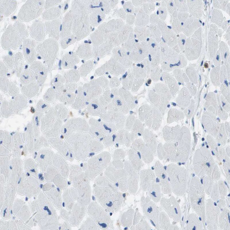 RIAM/APBB1IP Antibody - BSA Free Immunohistochemistry-Paraffin: RIAM/APBB1IP Antibody [NBP2-14300]