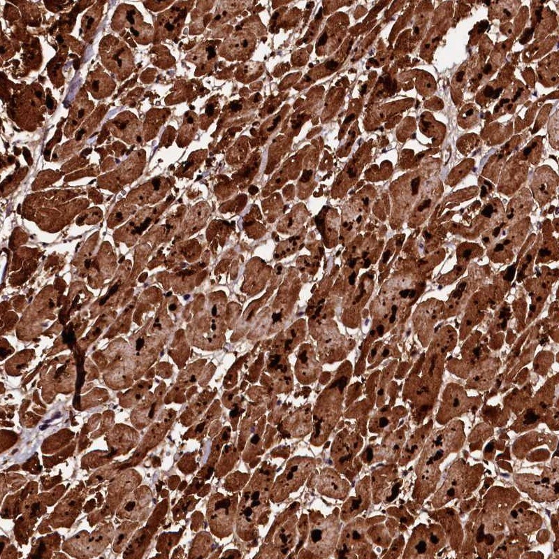 DIP13B Antibody - BSA Free Immunohistochemistry-Paraffin: DIP13B Antibody [NBP2-14303]