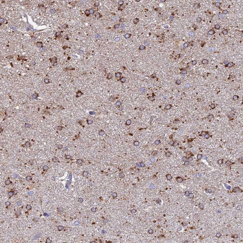 ARL8A Antibody - BSA Free Immunohistochemistry-Paraffin: ARL8A Antibody [NBP2-14314]
