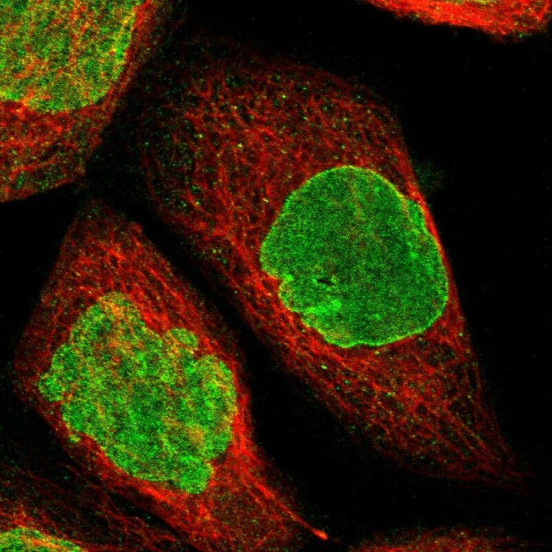 BRIP1/FANCJ Antibody - BSA Free Immunocytochemistry/ Immunofluorescence: BRIP1/FANCJ Antibody [NBP2-14361]