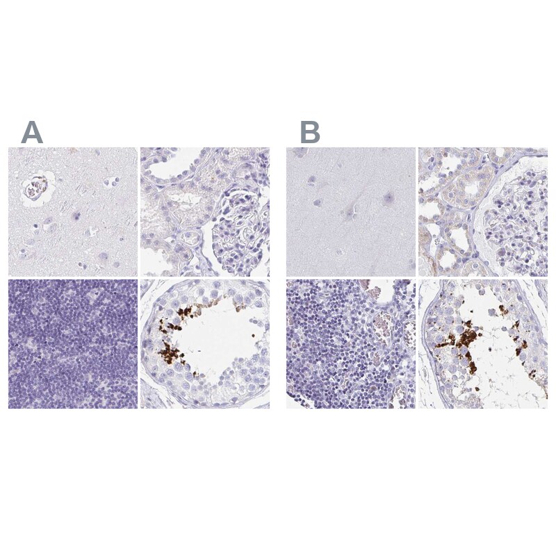 TEX44 Antibody Immunohistochemistry-Paraffin: TEX44 Antibody Antibody [NBP2-14406]
