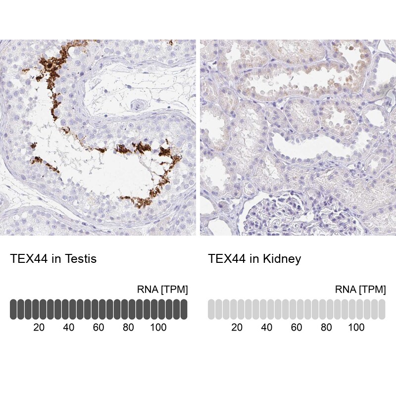 TEX44 Antibody Immunohistochemistry-Paraffin: TEX44 Antibody [NBP2-14406]