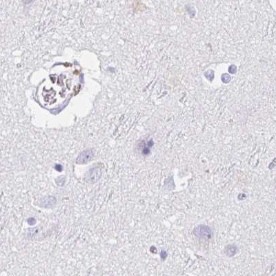 TEX44 Antibody Immunohistochemistry-Paraffin: TEX44 Antibody [NBP2-14406]