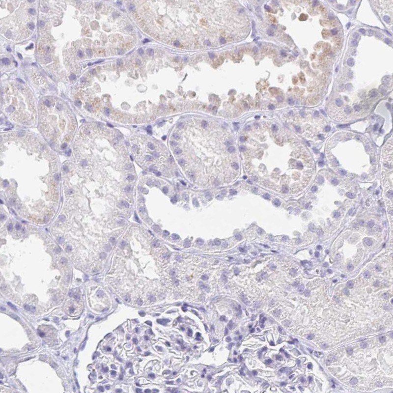 TEX44 Antibody Immunohistochemistry-Paraffin: TEX44 Antibody [NBP2-14406]