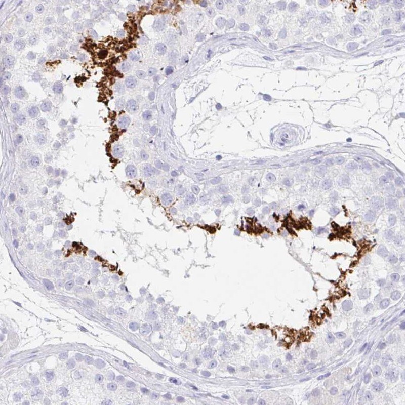 TEX44 Antibody Immunohistochemistry-Paraffin: TEX44 Antibody [NBP2-14406]