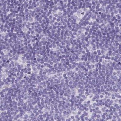 TEX44 Antibody Immunohistochemistry-Paraffin: TEX44 Antibody [NBP2-14406]