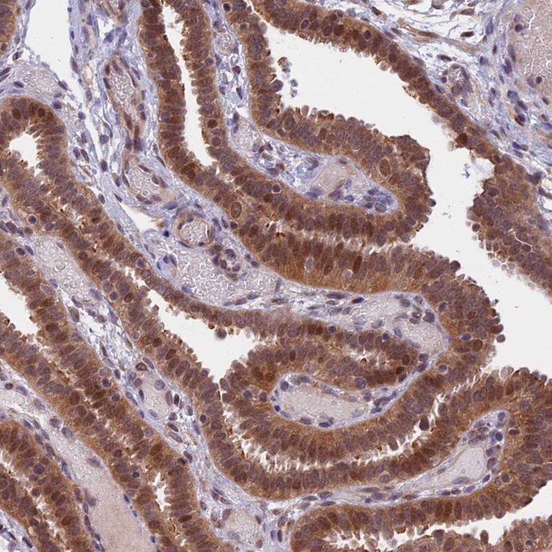 CCDC113 Antibody - BSA Free Immunohistochemistry-Paraffin: CCDC113 Antibody [NBP2-14444]