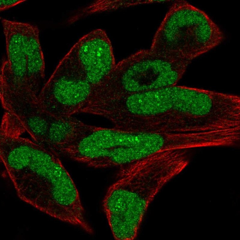 CHD1 Antibody - BSA Free Immunocytochemistry/ Immunofluorescence: CHD1 Antibody [NBP2-14478]