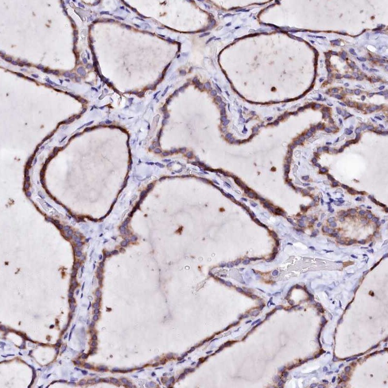 BTBD16 Antibody - BSA Free Immunohistochemistry: BTBD16 Antibody - BSA Free [NBP2-14507]