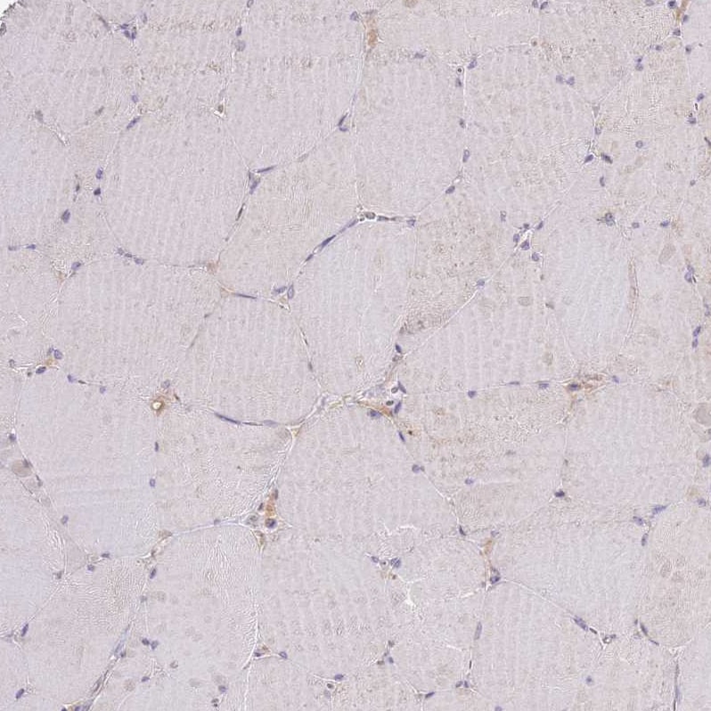 SHROOM3 Antibody Immunohistochemistry: SHROOM3 Antibody [SHROOM3 Antibody]