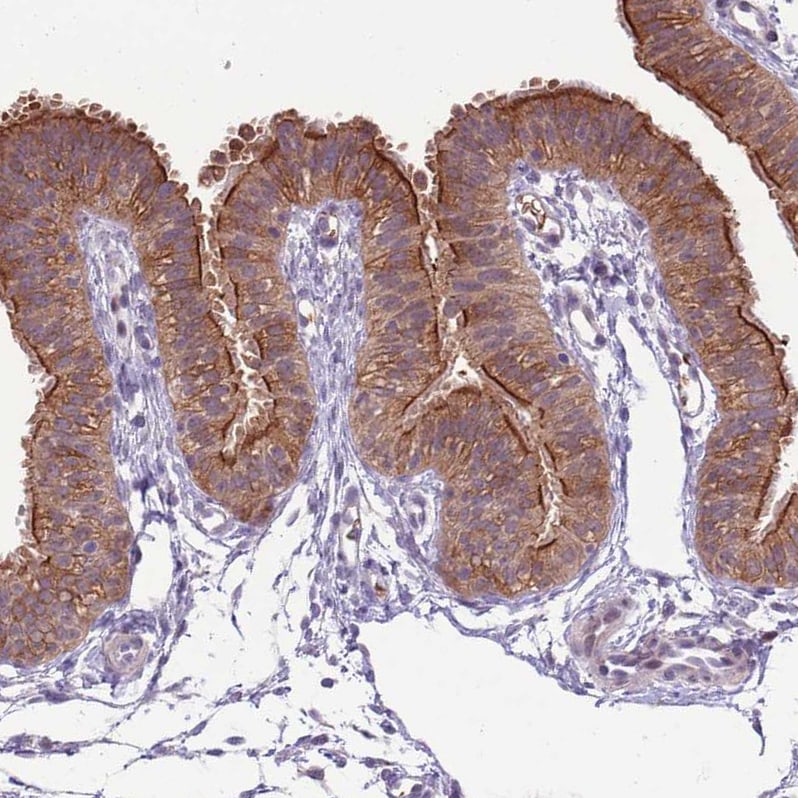 SHROOM3 Antibody Immunohistochemistry: SHROOM3 Antibody [SHROOM3 Antibody]