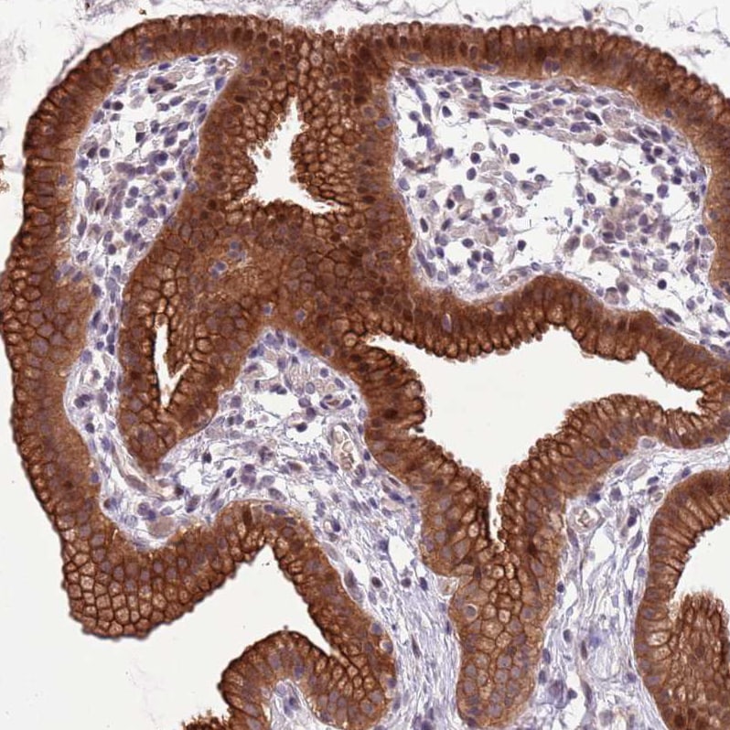 SHROOM3 Antibody Immunohistochemistry: SHROOM3 Antibody [SHROOM3 Antibody]