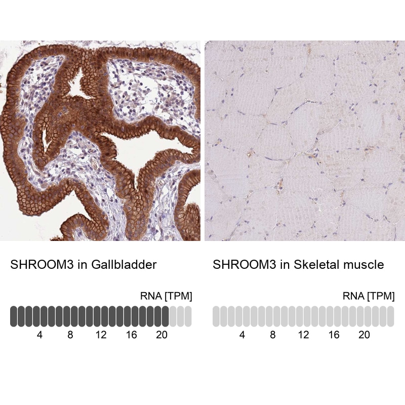 SHROOM3 Antibody Immunohistochemistry: SHROOM3 Antibody [SHROOM3 Antibody]