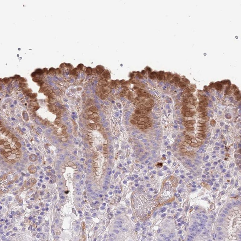 FAM108C1 Antibody Immunohistochemistry-Paraffin: FAM108C1 Antibody [NBP2-14659] -