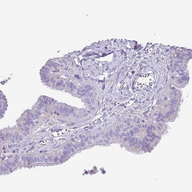 FAM108C1 Antibody Immunohistochemistry-Paraffin: FAM108C1 Antibody [NBP2-14659] -