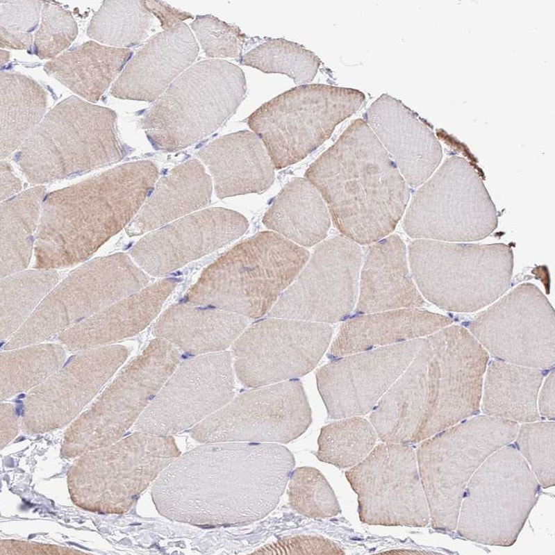 FAM108C1 Antibody Immunohistochemistry-Paraffin: FAM108C1 Antibody [NBP2-14659] -